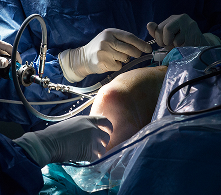 �������� ���� ���ð��� ����